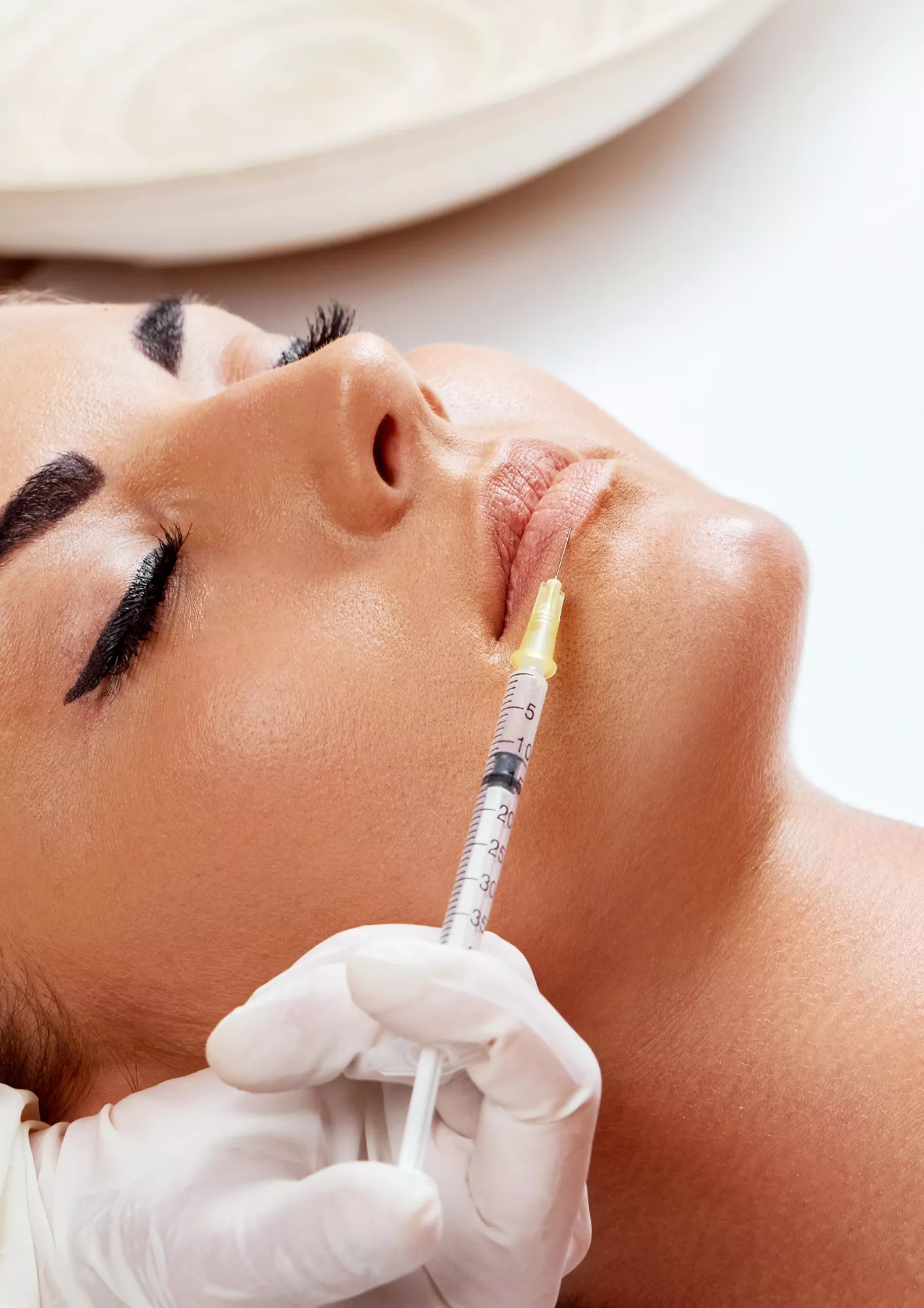injection-levres-acide-hyaluronique-paris