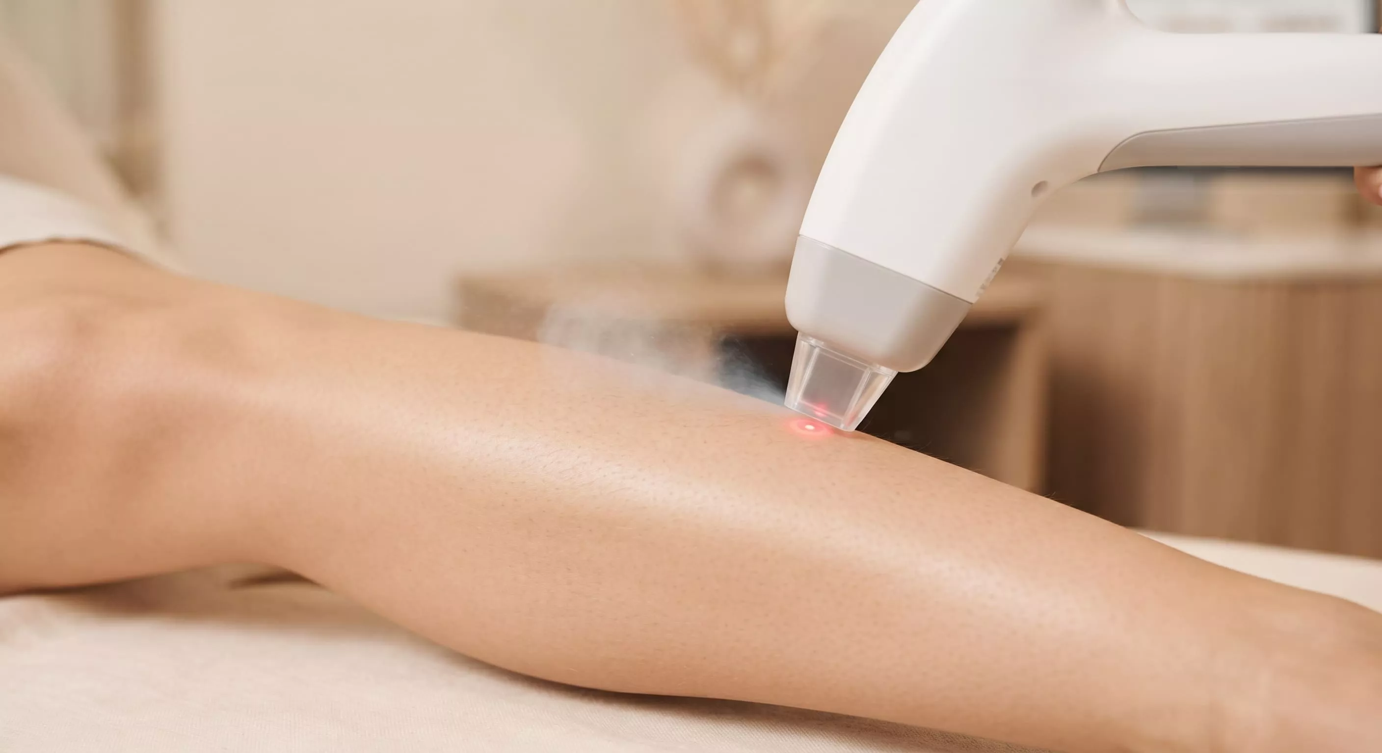 Combien de séances d’épilation laser pour un résultat durable