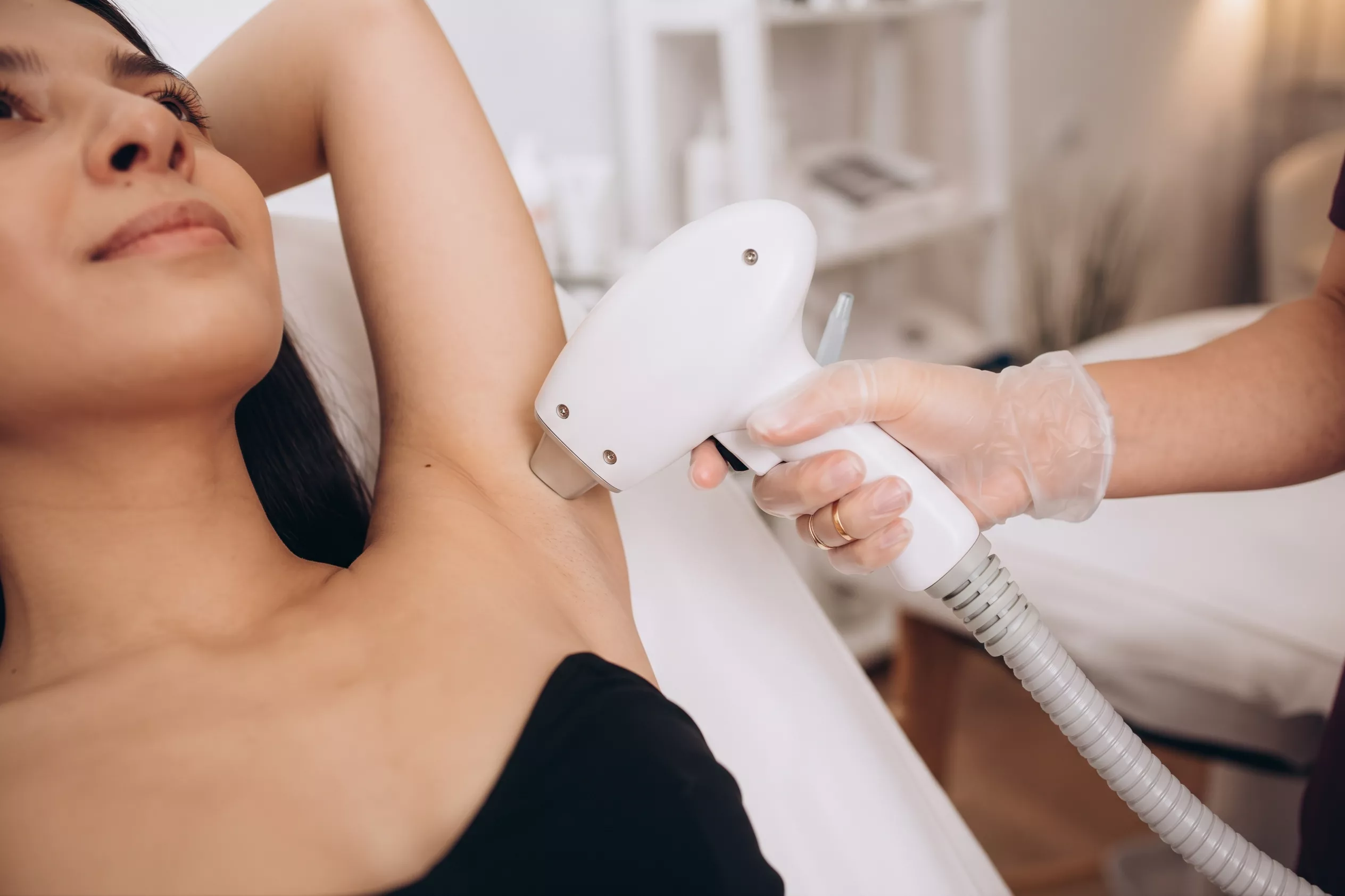 Avant et après une séance d’épilation laser : le mode d’emploi